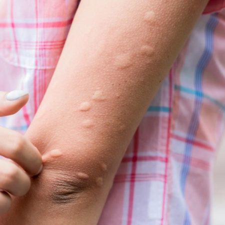 The definitive trick to get rid of mosquitoes in summer: thus you must use cinnamon according to this grandmother's experience