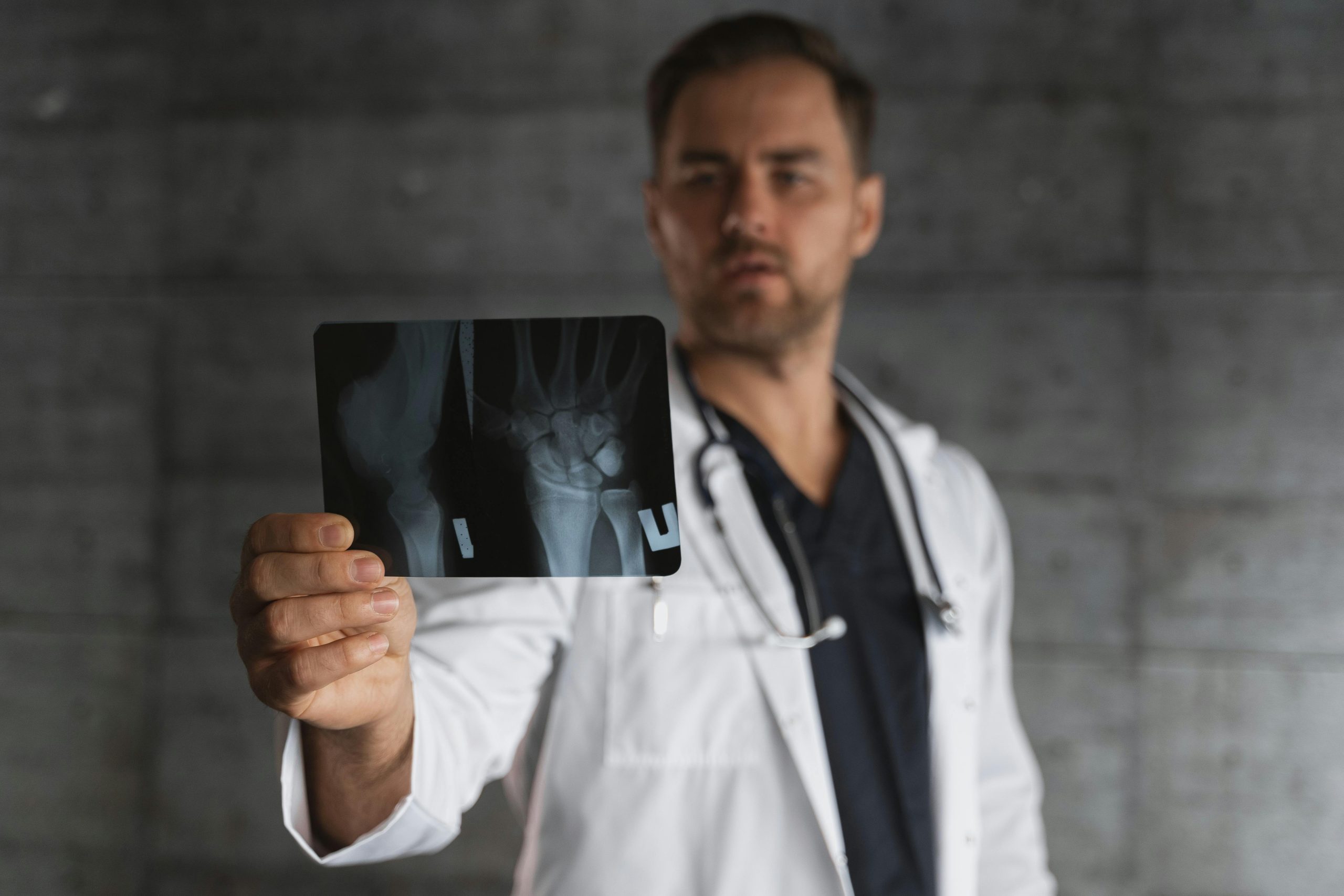 Descubre el Innovador 'Pegamento Óseo' que Revolucionará la Reparación de Fracturas: Un Avance Científico Asombroso Descubre el Innovador 'Pegamento Óseo' que Revolucionará la Reparación de Fracturas: Un Avance Científico Asombroso